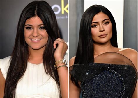 Kylie Jenner, Before and After